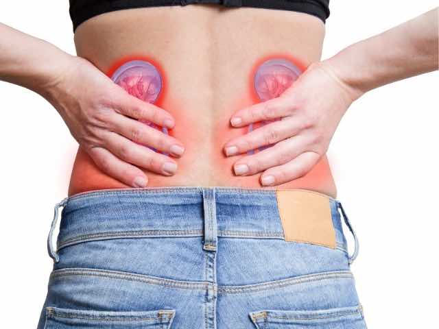 Böbrek Taşlarından Kurtulmak Kolay