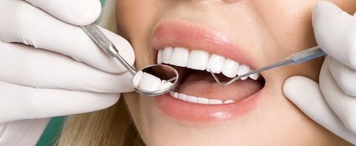 Düğün İçin Gülüş Tasarımı