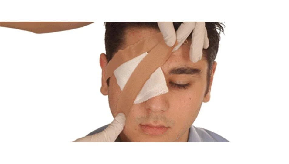 Göz Yaralanmalarına Müdahale