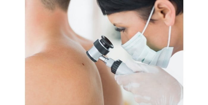 Güneş ve Deri Kanseri İlişkisi