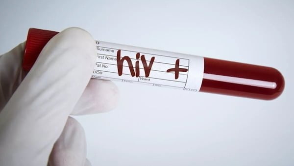 HIV ile Yaşayan Kadınlar