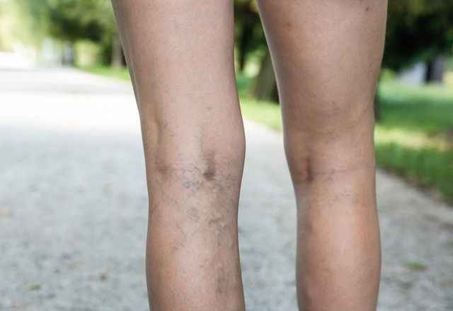 Kadınların Mor Kabusu Varis