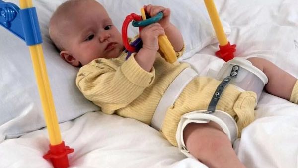 Kalça Çıkığında Birinciyiz