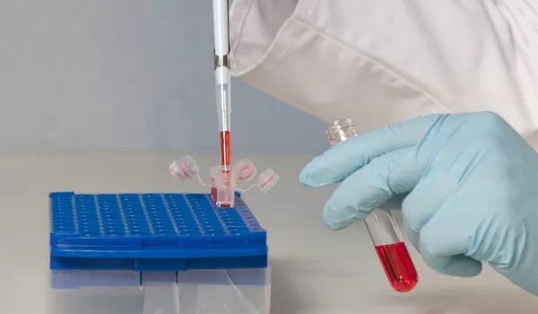 Kan Tahlili Yaptırmadan Demir Takviyesi Kullanmayın