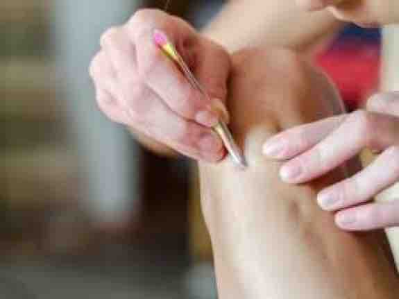 Kıl Dönmesi Tedavisi İhmale Gelmez