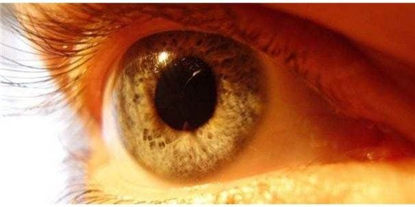 Omega Sarı Nokta Riskini Azaltıyor