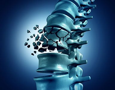 Osteoporoz Risk Faktörleri