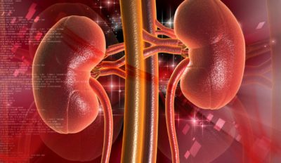 Portakal Suyu Böbrek Taşı Riski Düşürür