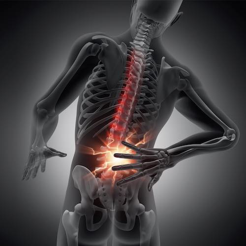 Prostat Kanserinde Kalça Ağrısı