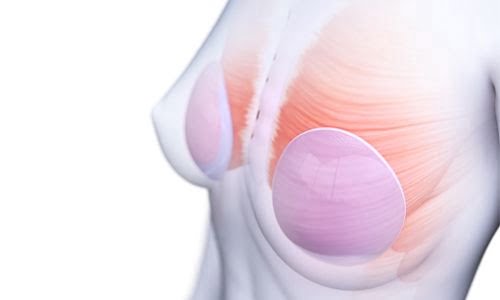 Silikon Kanser Riskini Gizler mi?