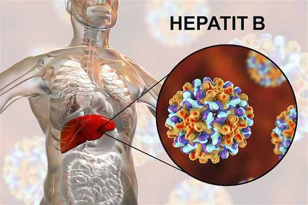 Ürküten Virüs Hepatit B