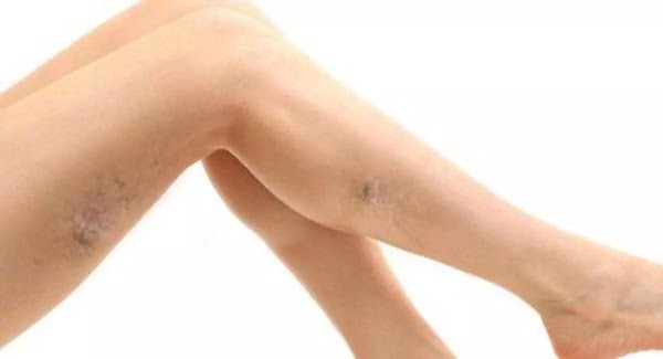 Varis ile Yaz Kabusu