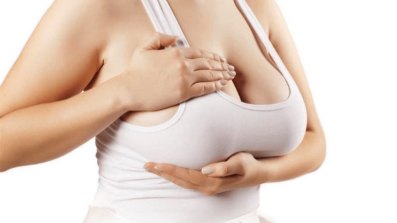 Sarkık Göğüslere Operasyonsuz Çözüm