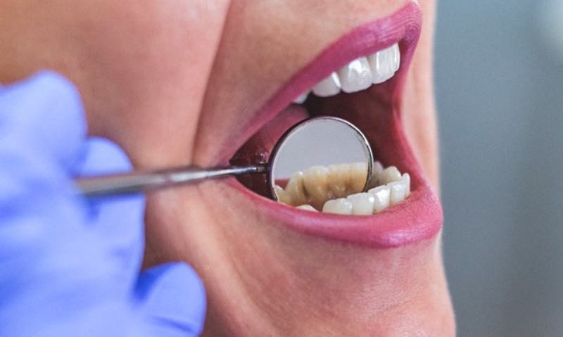 Diş 10 Önemli Belirti Verirse