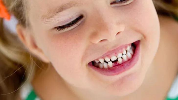 Süt Dişlerini Koruyun