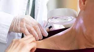 Cilt Kanseri Kişiye Özel Tedavi