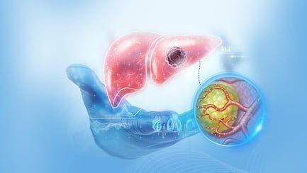Karaciğer Kanseri ve Mikro Küre