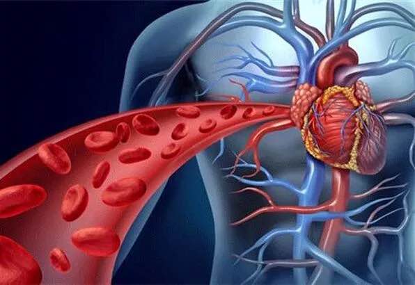 Sinsi Tehlike Anevrizma