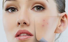 Ben Kanser Habercisi mi?