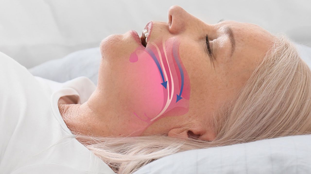 İşitme Kaybının Sürpriz Nedenleri