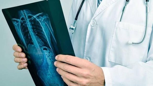 İmmunoterapi Tedavileri Raporu Yayınlandı