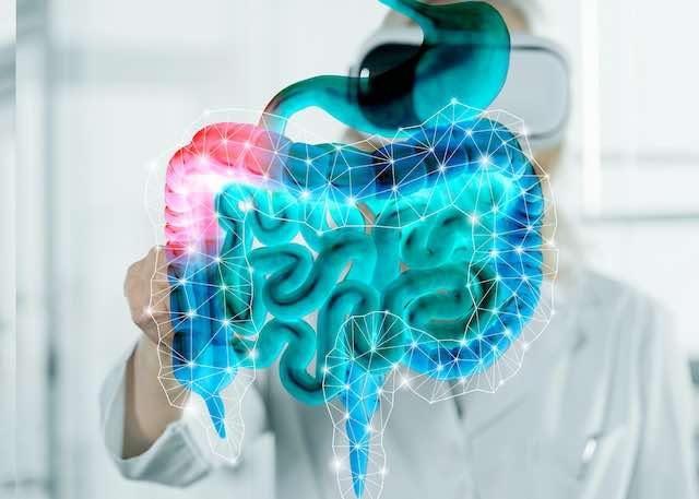 Kolon Kanseri Erkekleri Seçiyor