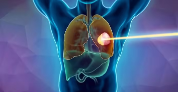 Tümöre Canlı Takip